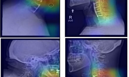 KI-Doktor: Neuronale Netze lernen von Röntgenbildern