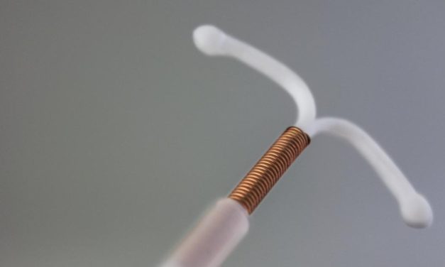 Gefährlicher TikTok-Trend: Frauen entfernen Spirale selbst