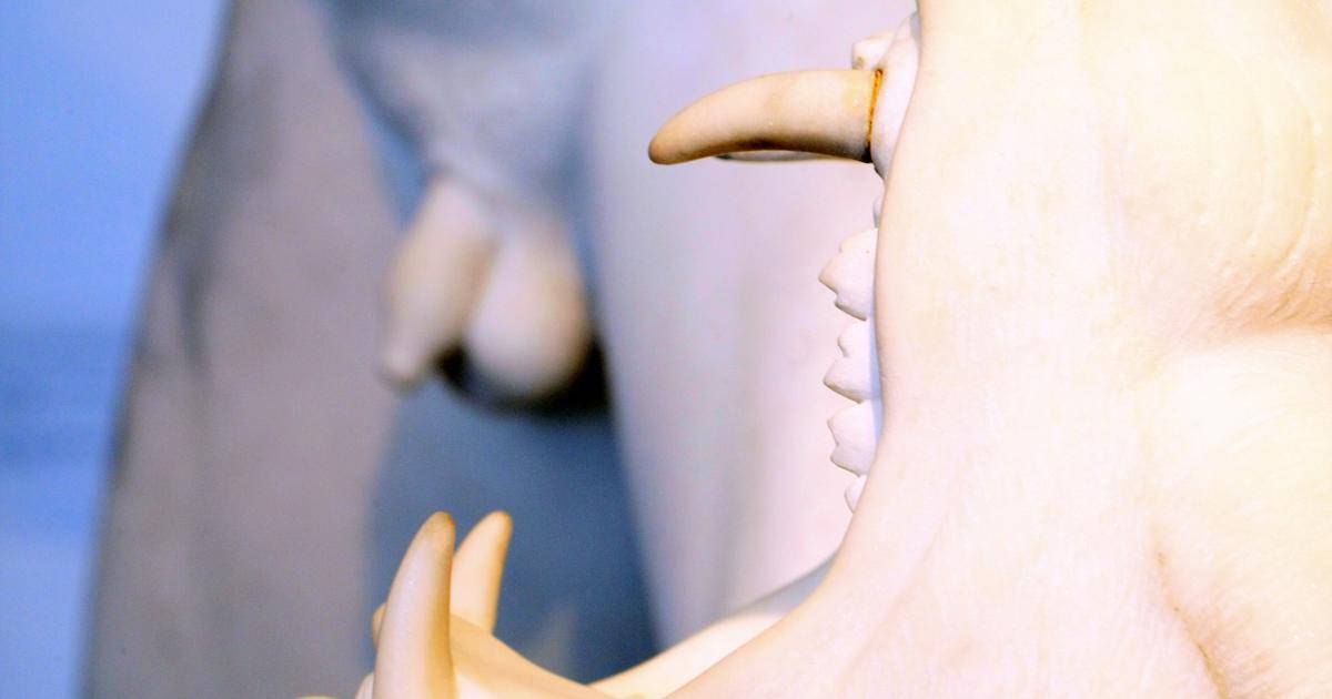 Österreich-Premiere: Roboter und Sonde machen Tumor hörbar