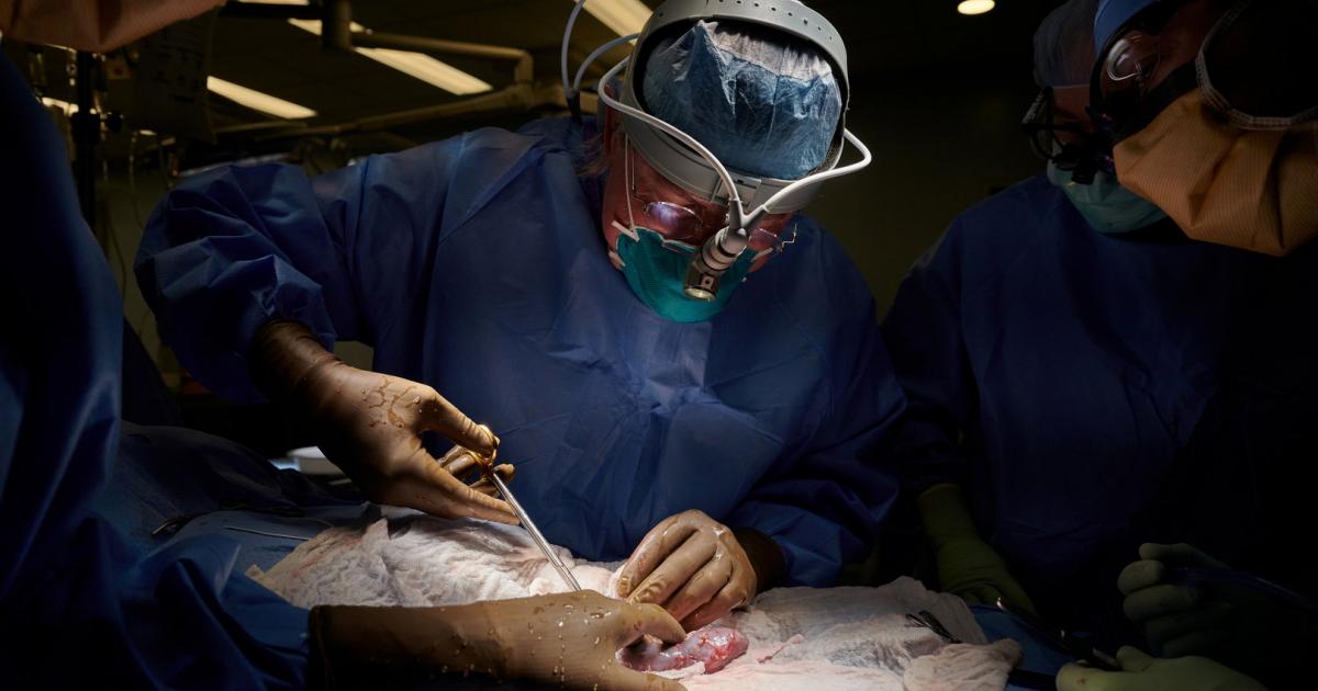Erstmals erfolgreich Schweineniere in Menschen transplantiert