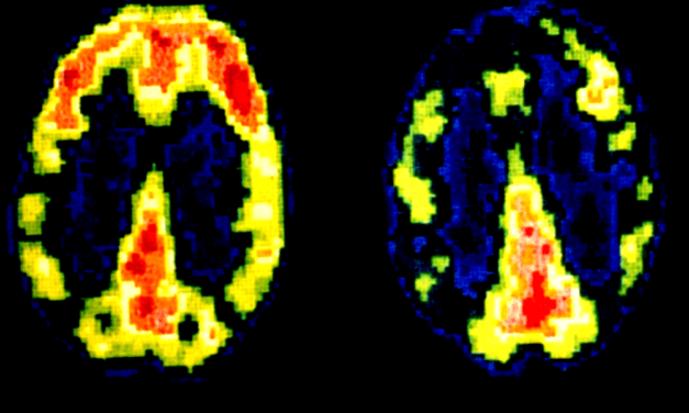 Wie das Gehirn eines Mörders aussieht