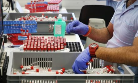 Nach PCR-Test-Problemen setzt Land Salzburg nun auf Lifebrain