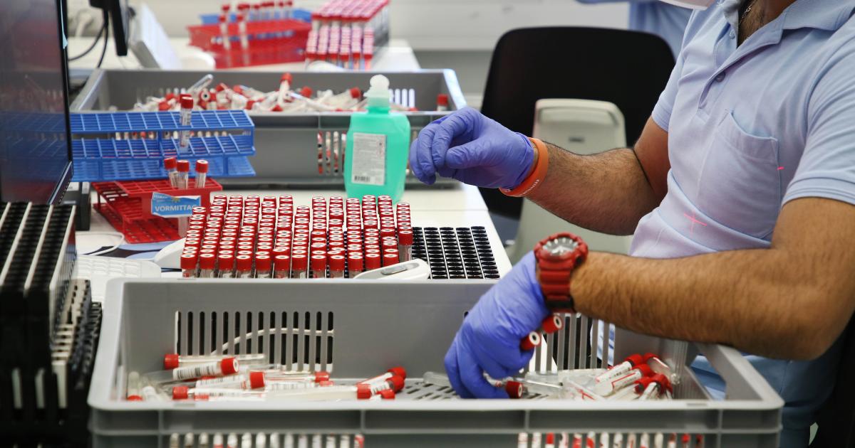 Nach PCR-Test-Problemen setzt Land Salzburg nun auf Lifebrain