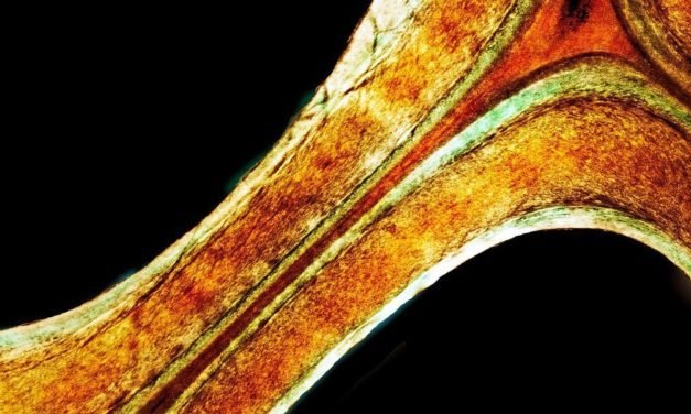 Kunststoff aus Holzabfall könnte Erdöl ersetzen