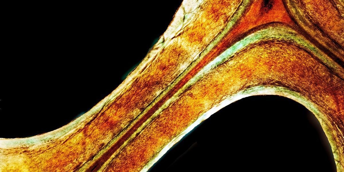 Kunststoff aus Holzabfall könnte Erdöl ersetzen