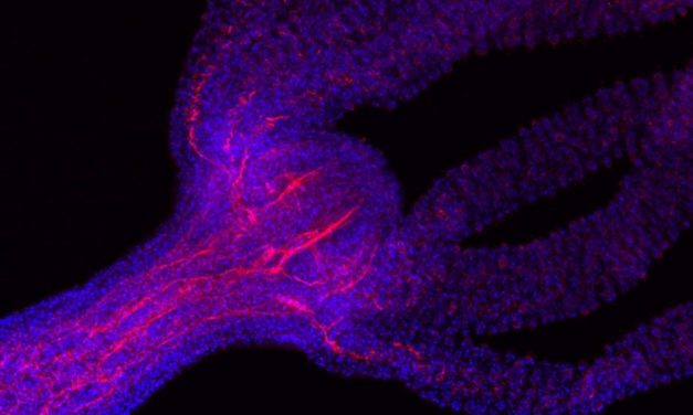 Die reale Hydra, die ihre Köpfe nachwachsen lässt
