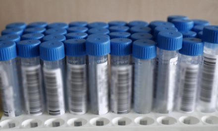 Omikron-Suche in Österreich: „Wir blicken in den Rückspiegel“