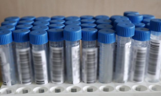 Österreich hinkt bei Omikron-Suche ordentlich hinterher