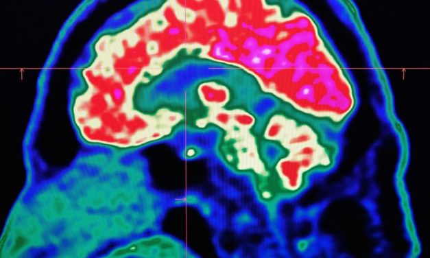 „Tsunami“ im Gehirn: Einsichten in die Neurobiologie des Sterbens