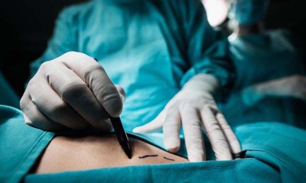 Sterblichkeitsrisiko erhöht: Wenn Frauen von Männern operiert werden