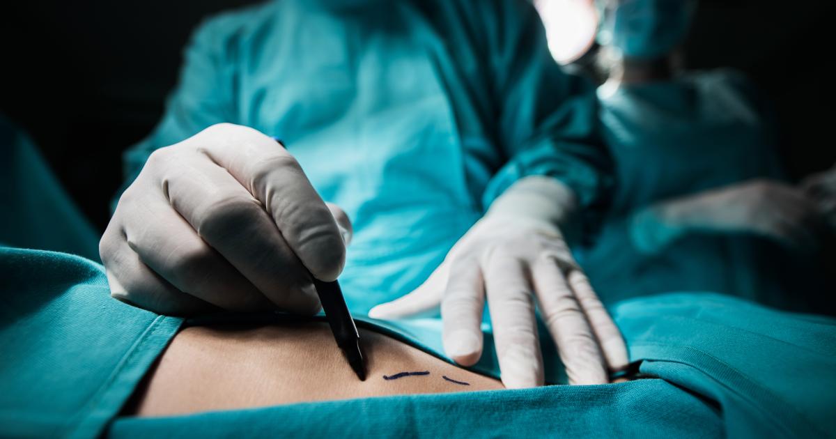 Sterblichkeitsrisiko erhöht: Wenn Frauen von Männern operiert werden