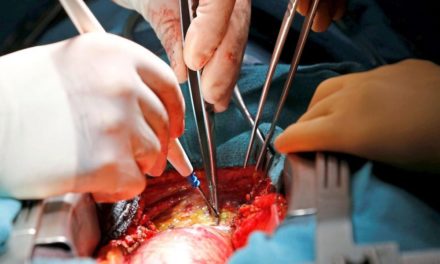 Grazer Forscher berechnete Hauptschlagadermuskel-Eigenschaften