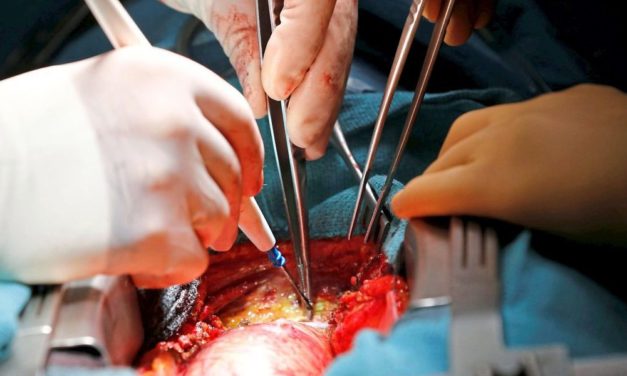 Grazer Forscher berechnete Hauptschlagadermuskel-Eigenschaften