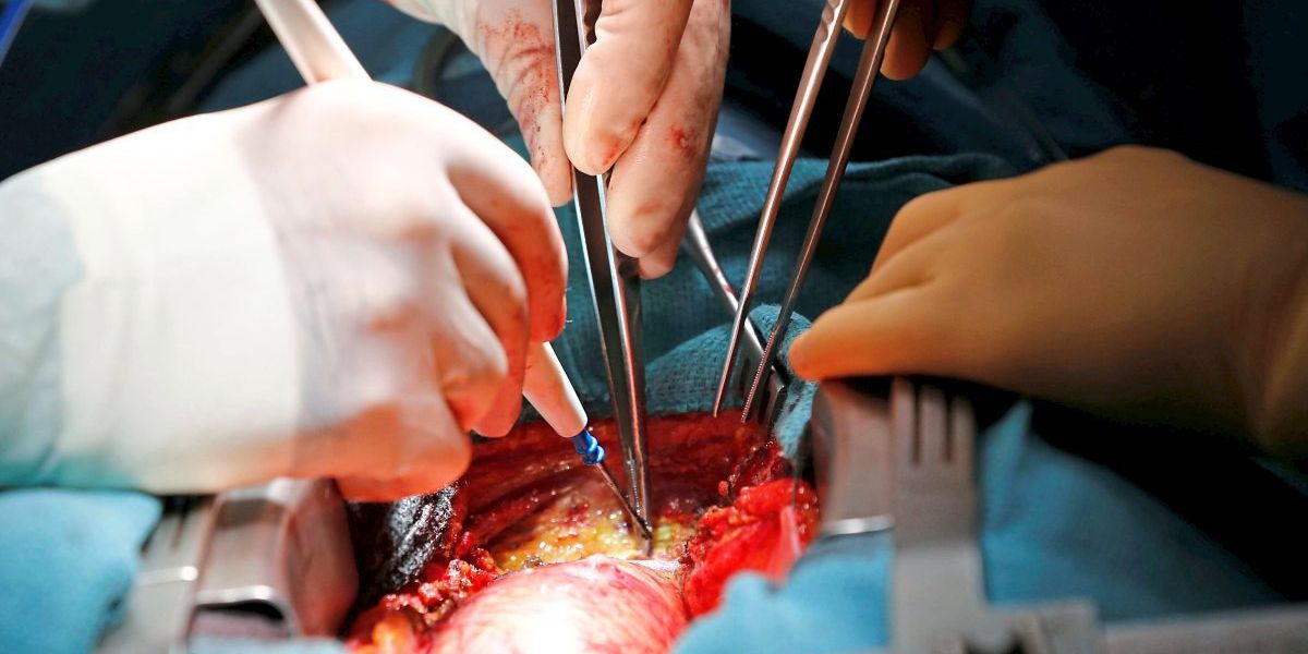 Grazer Forscher berechnete Hauptschlagadermuskel-Eigenschaften