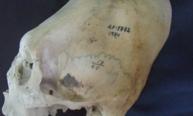 Was mysteriöse peruanische Turmschädel über Identität verraten