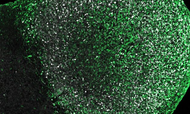 Gehirn von Menschen ist verwundbarer als das von Mäusen