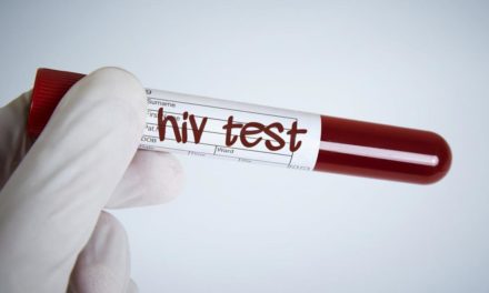 Viren-Evolution: Aggressivere HIV-Variante in Holland entdeckt