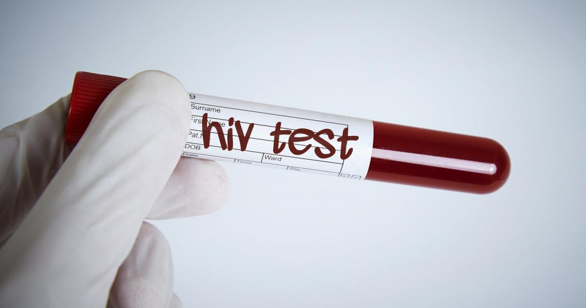 Viren-Evolution: Aggressivere HIV-Variante in Holland entdeckt