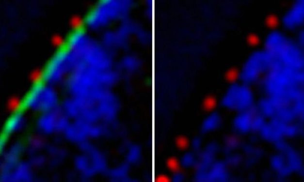 Flexible Körbe ermöglichen gezielten Massentransport aus Zellkern