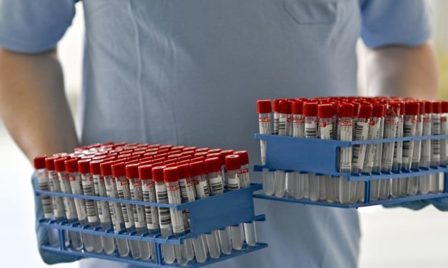 Wer mit den Gratis-PCR-Tests am meisten Umsatz macht