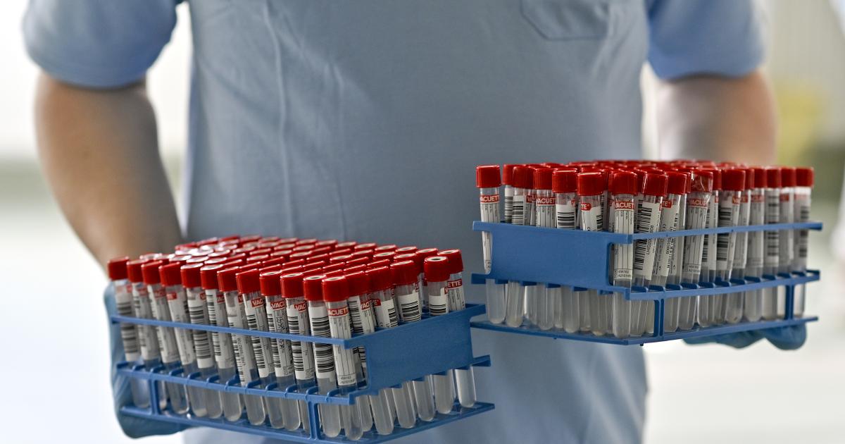 Wer mit den Gratis-PCR-Tests am meisten Umsatz macht