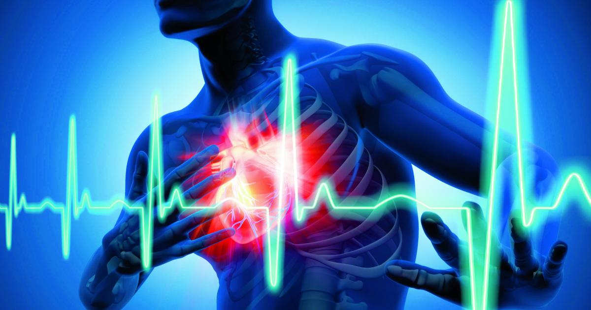 Verdoppelung der Herzinfarkte in den vergangenen zehn Jahren