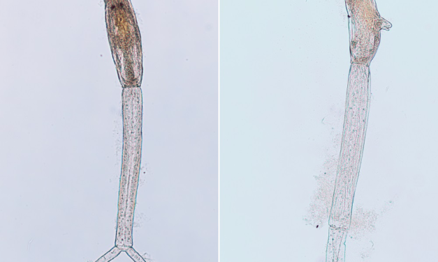 Parasitischer Saugwurm aus Nordamerika in oberösterreichischem Badesee entdeckt