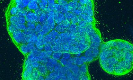 Vielversprechender Wiener Wirkstoff könnte Krebs verlangsamen