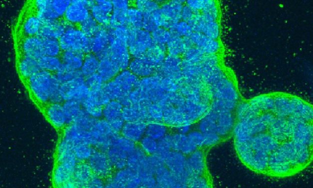 Vielversprechender Wiener Wirkstoff könnte Krebs verlangsamen