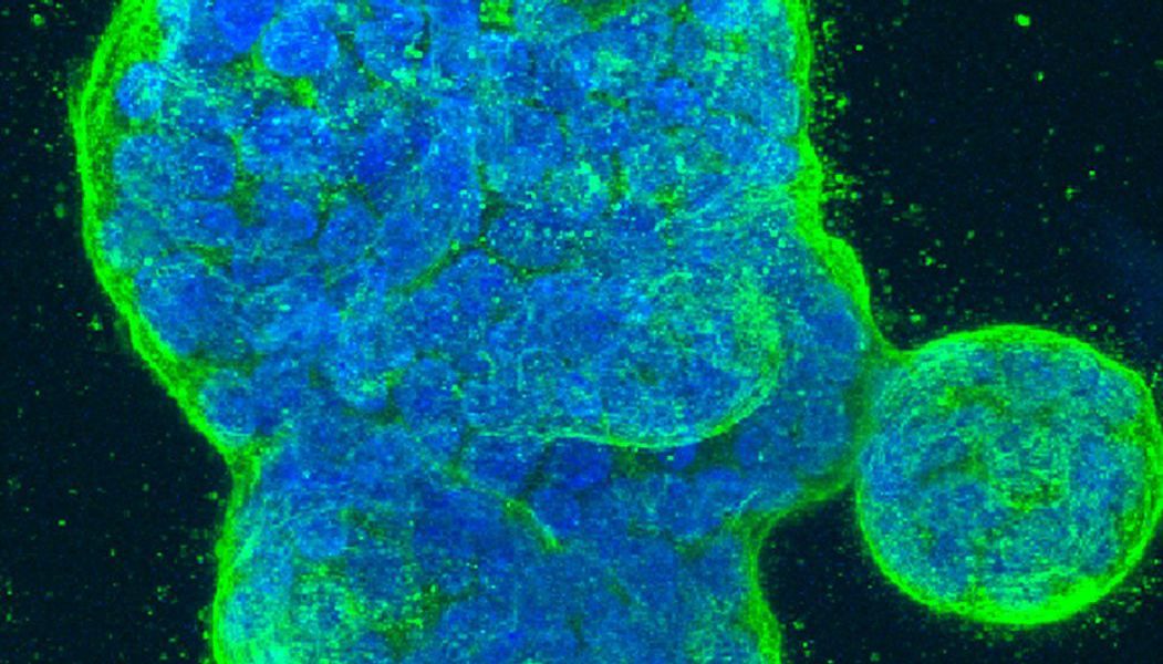 Vielversprechender Wiener Wirkstoff könnte Krebs verlangsamen