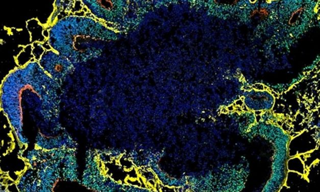 Menschliche Minigehirne helfen, Autismus zu verstehen