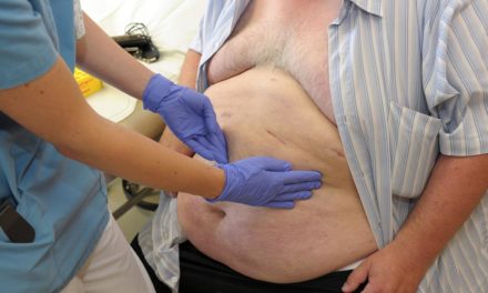 Hoher Anstieg: 1,2 Mio. Menschen in Österreich sind fettleibig