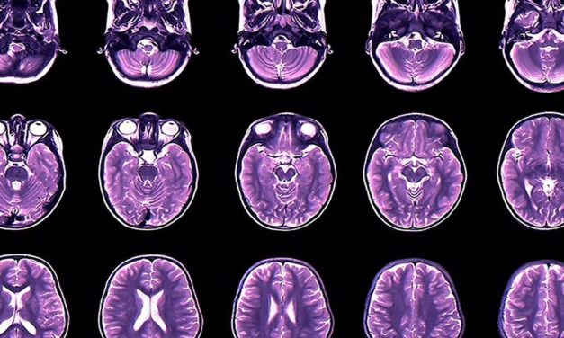 Graue Gehirnsubstanz wächst und schrumpft im Laufe der Zeit