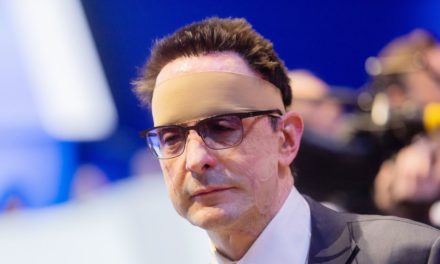 Säureanschlag: Anklage gegen Belgier wegen Angriff auf Ex-RWE-Manager