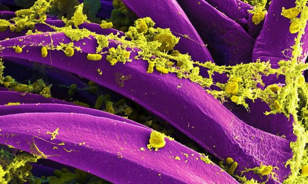 „Steinzeit-Pest“ wütete in Europa bereits vor über 6.200 Jahren