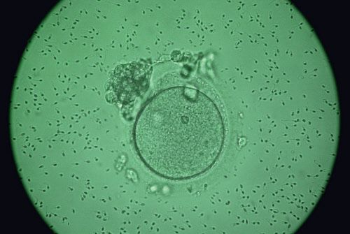 Möglicher Mutationsschutz bei alternden Eizellen entdeckt