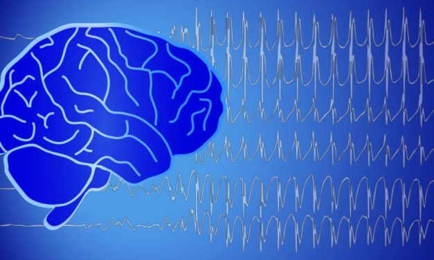 Epilepsie: „Eine Krankheit wie jede andere auch“