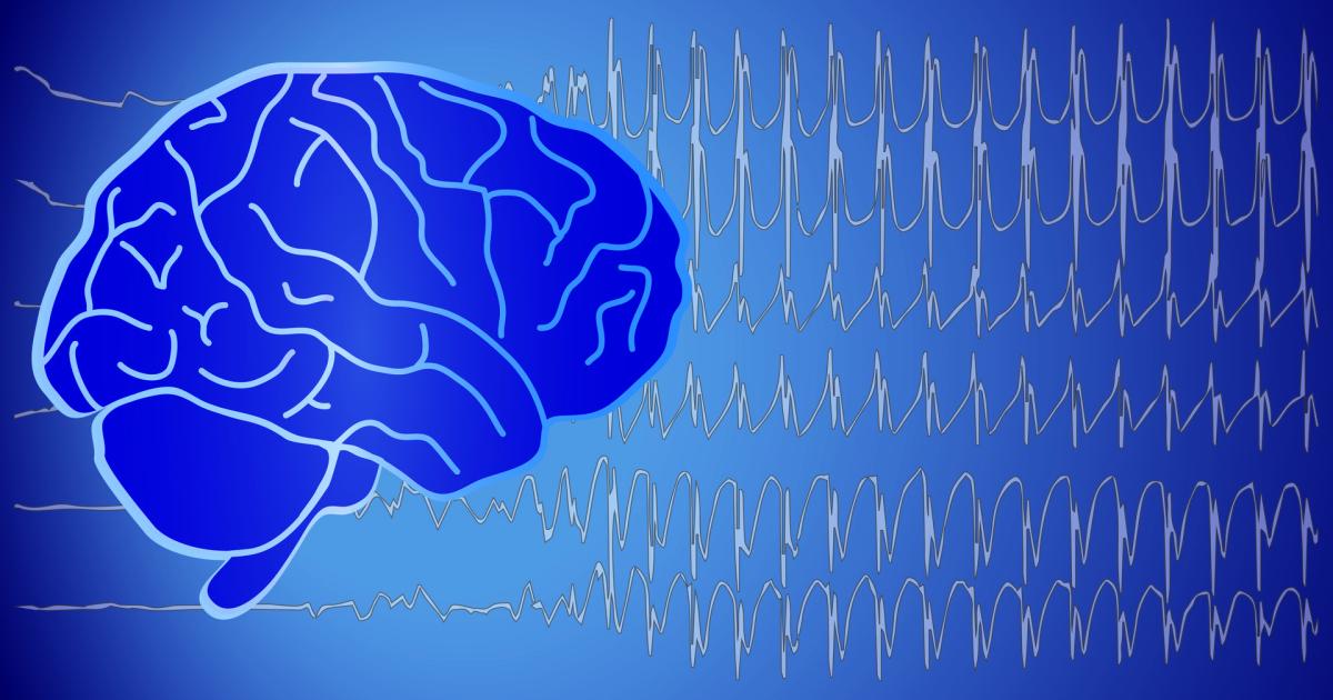 Epilepsie: „Eine Krankheit wie jede andere auch“