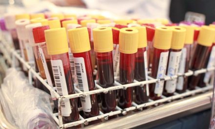 Blutvergiftungen schneller und mit weniger Aufwand erkennen