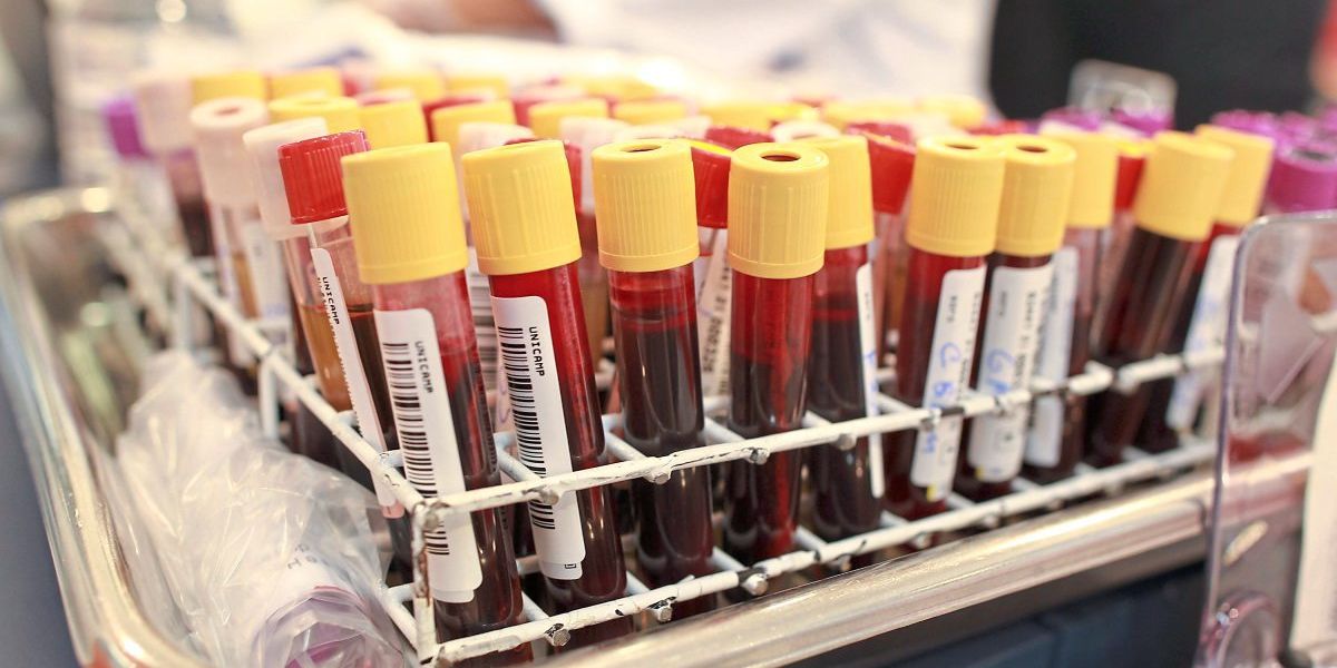 Blutvergiftungen schneller und mit weniger Aufwand erkennen