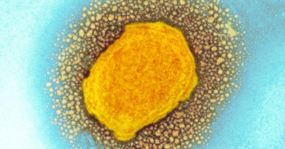 Affenpocken: Derzeit kein Grund zur Sorge