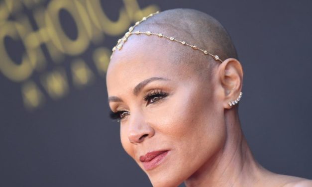 Alopezie: Medikament gegen Kreisrunden Haarausfall in USA zugelassen