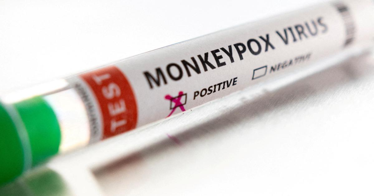 WHO prüft Berichte über Affenpockenviren in Sperma von Patienten