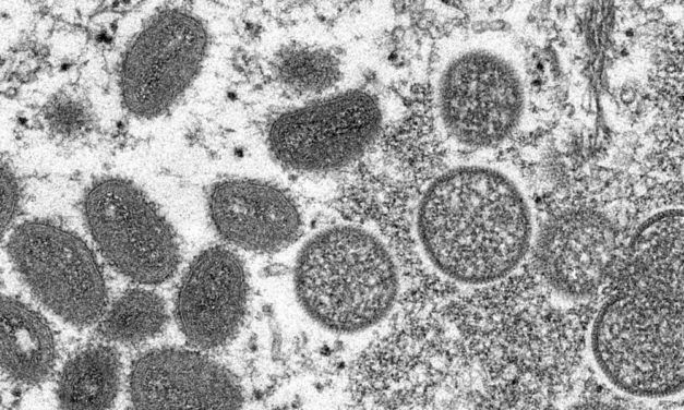 Virus der Affenpocken mutierte überraschend stark
