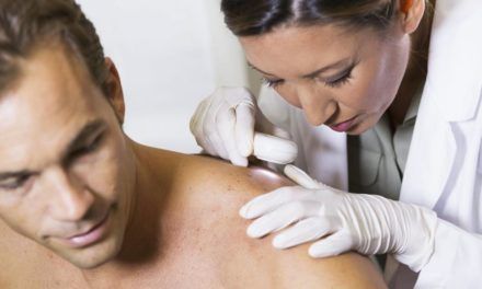 Radioaktive Paste soll weißen Hautkrebs heilen